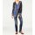 Print tunic, blue